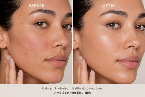 AMS Soothing Emulsion - Hydrating Moisturizer Emulsion